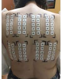 Patch testing